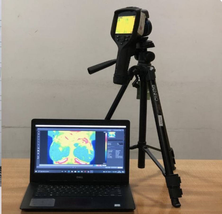 Niramai AI Health Screening System